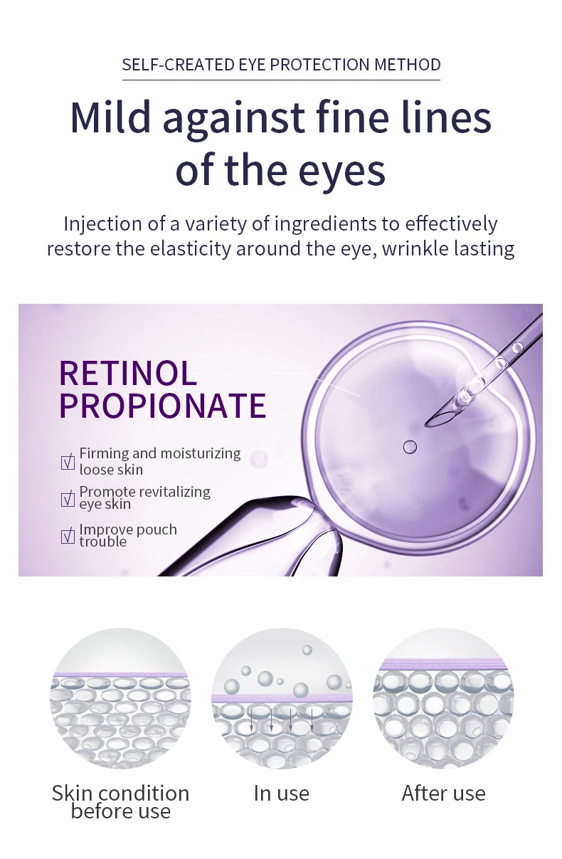 OCHEAL Anti Wrinkle Eye Cream with Roller -Hydrates & Reduces Dark Circles